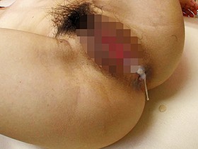 不妊治療クリニックで孕まされて…　サンプル画像08